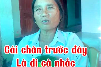 Hieu qua su dung nuoc cot nhau NONI4X Dau chan